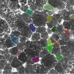 Figure 1b) For certain types of analysis, the point cloud has to be split into individual trees. Here, beech trees are competing for their place in the canopy.